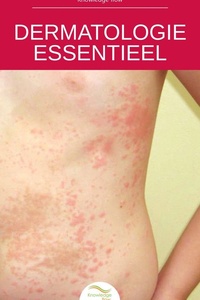 Reeks Medische Wetenschappen - Dermatologie Essentieel