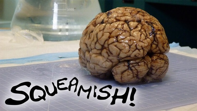 Squeamish!