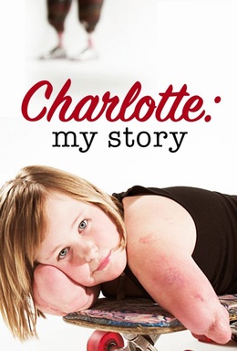 Charlotte: My Story