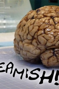 Squeamish!