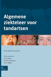 Algemene ziekteleer voor tandartsen