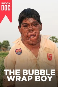 Shock Doc: The Bubble Wrap Boy