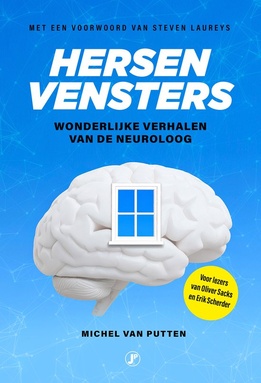 Hersenvensters